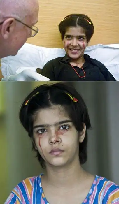 世界最恐怖变异人 男孩腹部长出连体手腿(组图) - 鲁网新闻中心