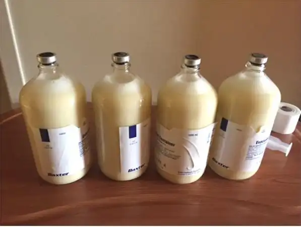 系统性红斑狼疮_乳糜液_医脉通