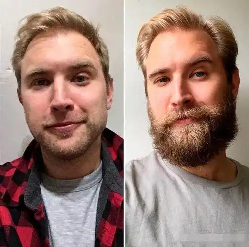 男人留胡子前后对比照,差别有很大额