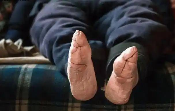 民国三寸金莲:靠小脚"嫁入豪门",洗脚痛到哭,丈夫却爱不释手