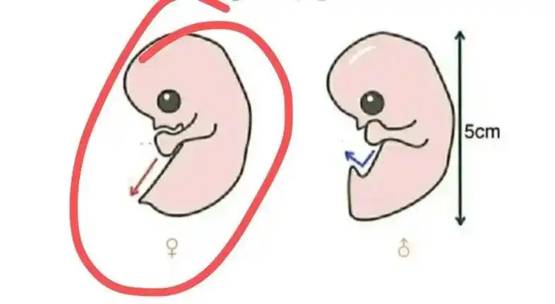 nt看宝宝男女你知道吗?英国nub点理论