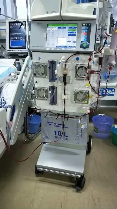 床旁血液滤过机