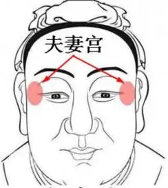 面相十67二宫位痣的位置与命运1.命宫有痣          2.财帛宫有痣3.