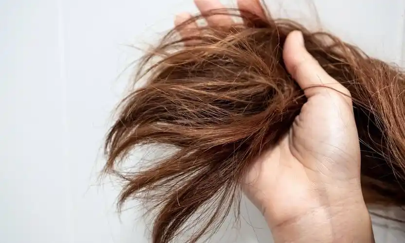 盘点四大类受损发质,对号入座,护发才有效