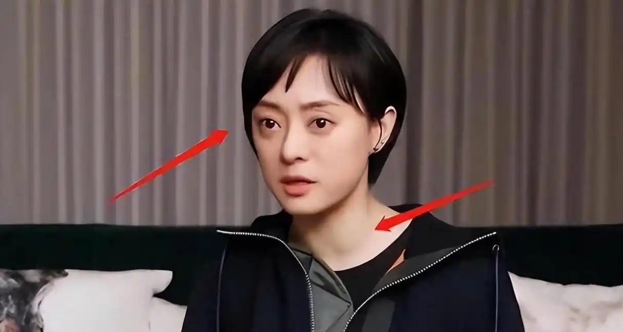 头秃眼凸,松弛显老,热衷养生的"娘娘"孙俪,现在遭到了反噬!