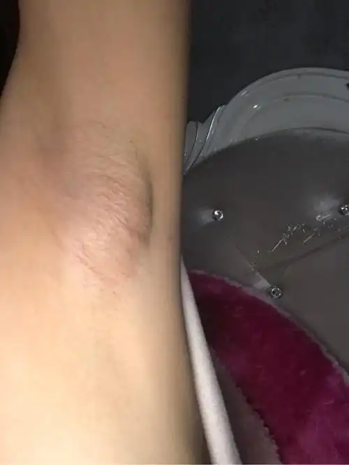 最近腋下长得有像肿块的东西_妈妈网轻聊_千万女人的共同选择