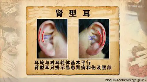 看耳朵能知道人的寿命长短常见病耳诊与按摩保健