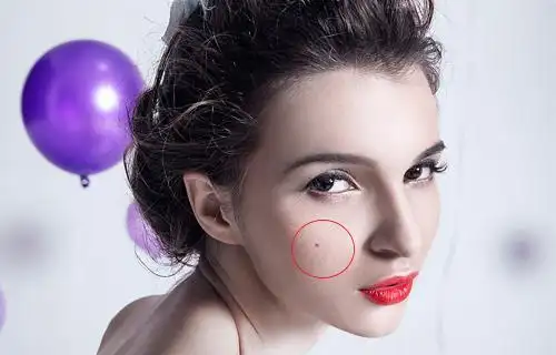 有这三颗痣的人,福星高照,好运不断,一生富贵多财