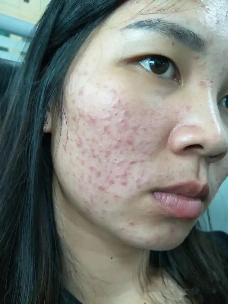 #问题性皮肤管理 人过一生一定精彩一点 - 抖音