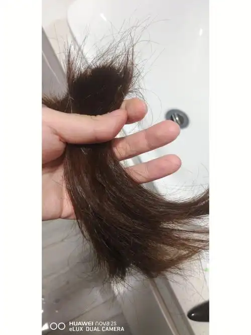 不过术后头发确实比之前脱落得厉害了,所以自己先剪掉一些,空了再去