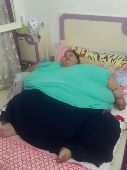 埃及女子eman ahmed被认为是世界上最重的女人,据她的家人称eman体重