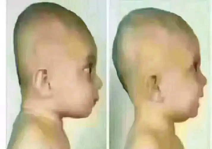 宝宝后脑勺大把子妈妈嫌弃不好看奶奶却说睡睡就好