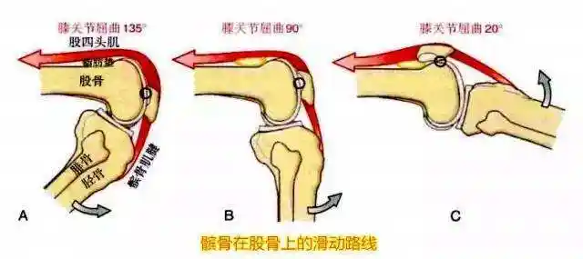 爬楼梯太难了,膝盖一弯曲就疼,骨科医生教你这种情况如何处理