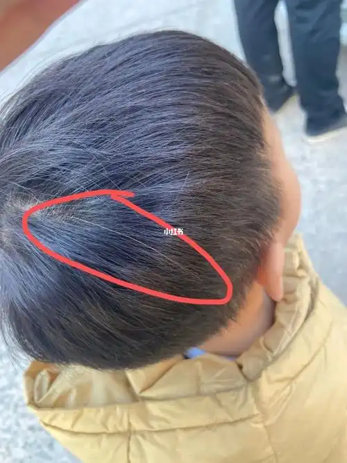 2岁多小孩子竟然长白头发了?_发现一根白头发_母婴_育儿经验