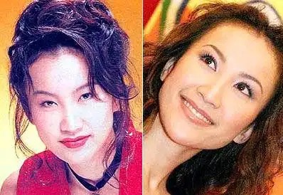 明星整容前后对比照