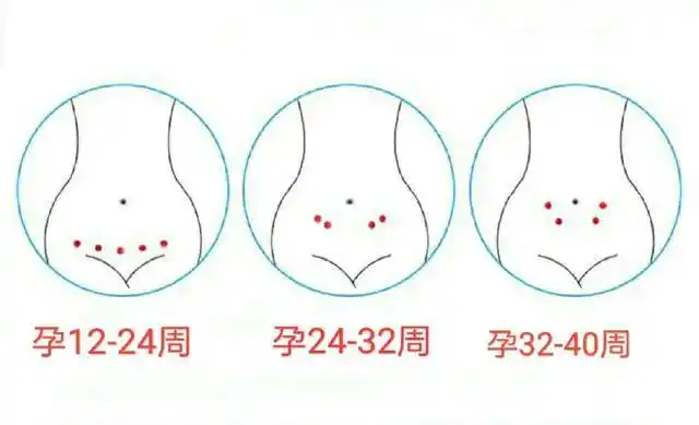 孕产说:小宝宝的胎心一般在哪个位置?