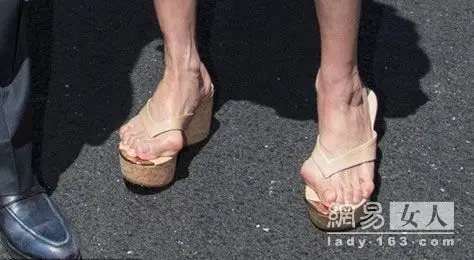 恐怖杨紫琼脚拇指严重外翻照片杨紫琼大脚骨病图片