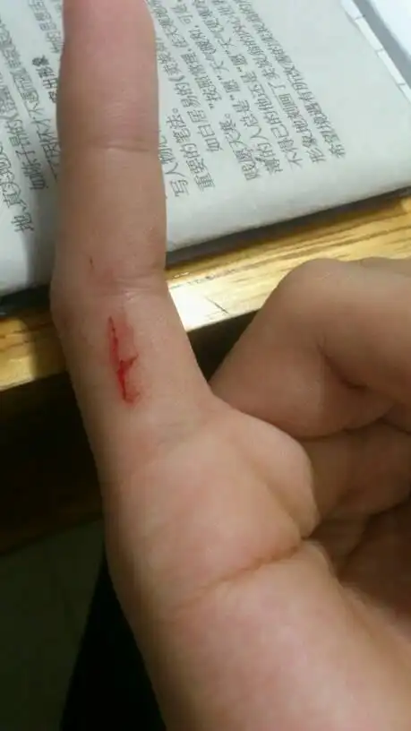手被割伤了,伤口不深,我在学校可能是被铁床或者塑料桶割到的,要怎么