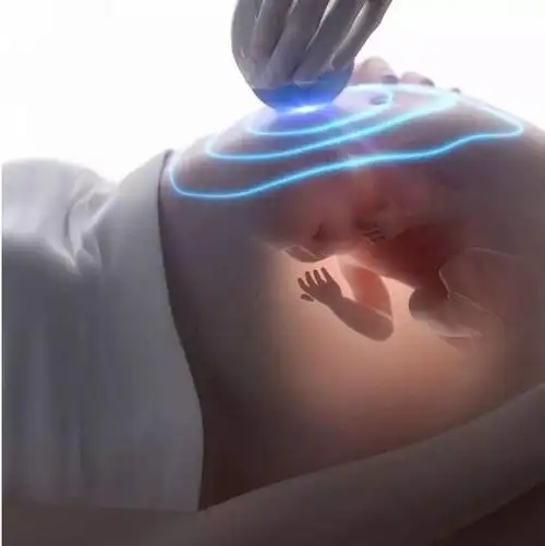 孕100天胎儿这3个方面已成型第1个无法改变第2个可微调