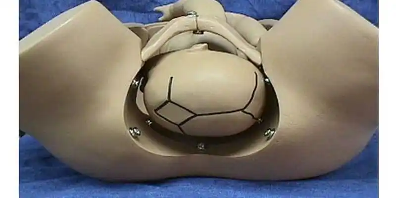 胎位lot左枕横示意图 - 梦幻算命网