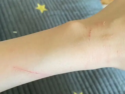 被家养的猫咪第二次咬脸,我该劝女友把它送走吗