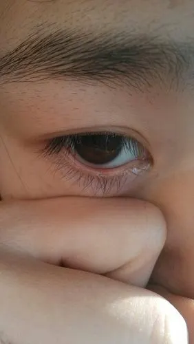 我的眼睛今早下眼睑内有个小白点,请问怎么回事,谢谢