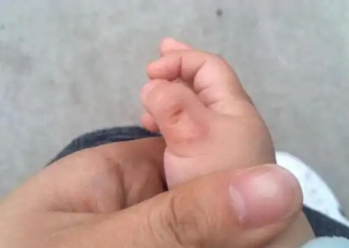 吃手指会是宝宝的天性吗?孩子吃手,爸妈到底管不管!