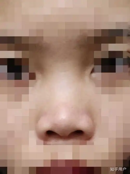 这才是真正的塌好吗! 那些有鼻梁的姐妹知足一点吧!