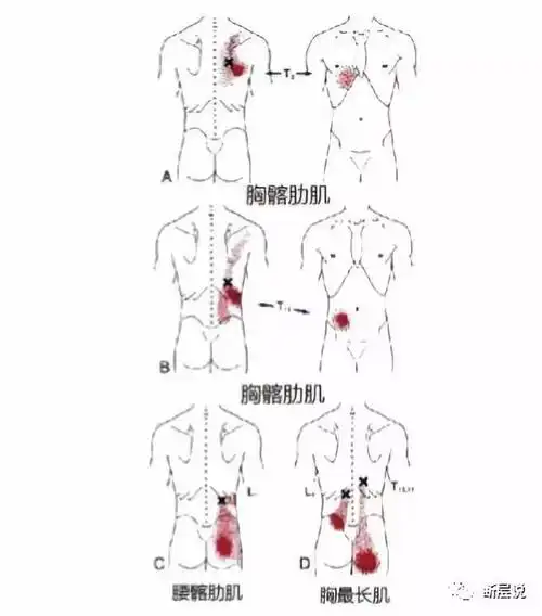 竖脊肌搓澡也能治疗腰背痛