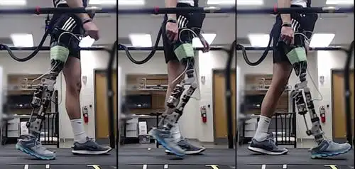 假肢具有电动膝盖,脚踝,帮助患者行走