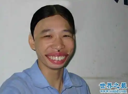 世界上最丑陋的女人,世界上20个最丑的人(怕吐勿看)