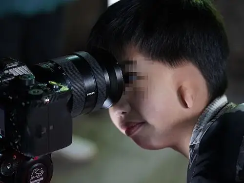 qing听丨深山里的无耳孩子有了新耳朵3