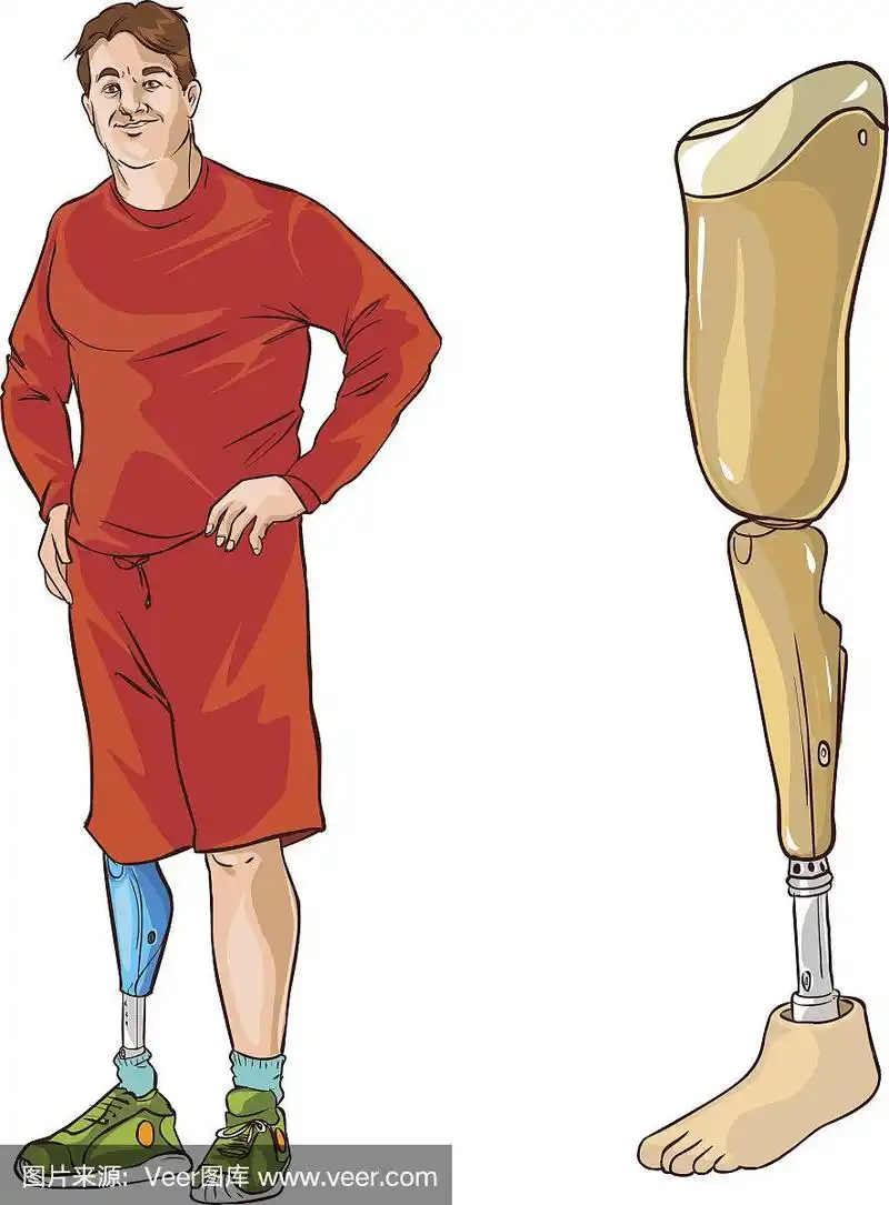 白色背景矢量插图的假肢腿