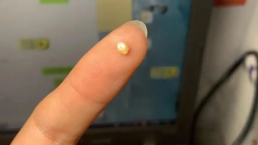 眼里掉出一颗"珍珠",我被闺蜜们敬为蚌精大人