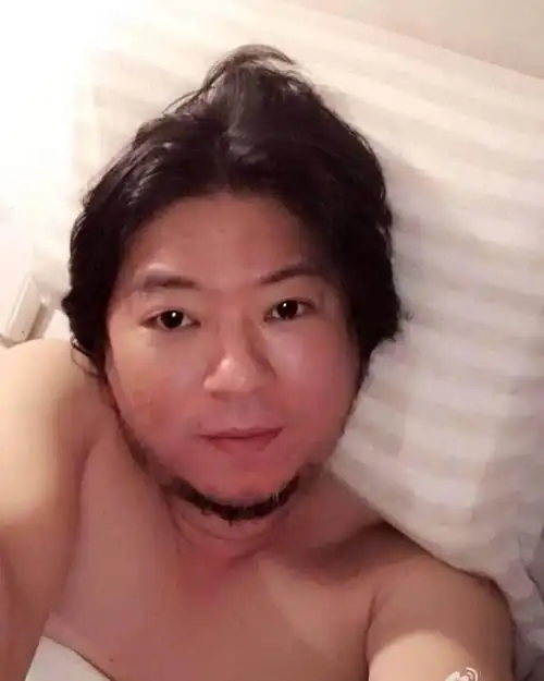 不敢相信! 这两个丑男整容后的颜值, 轰动了整个娱乐圈