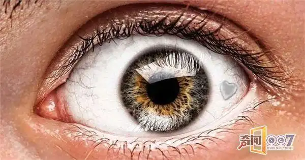 最近开始流行在眼珠子上动手脚看起来好痛