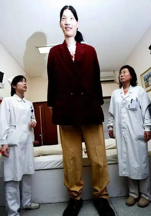 安徽"世界第一女巨人":穿78码鞋,一顿吃6碗面,41岁不幸离世_姚德芬