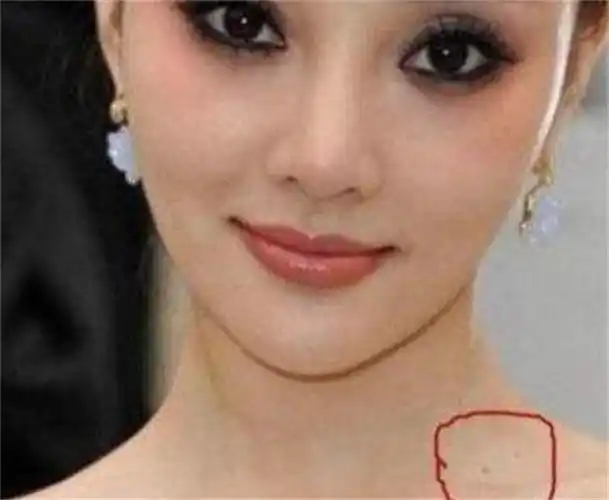 女人身上的真正桃花痣