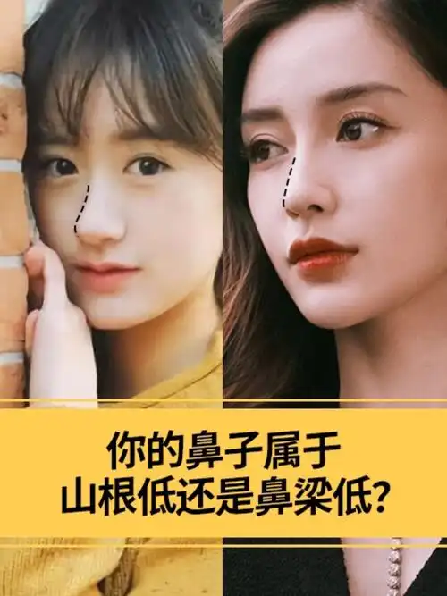 其实没隆鼻前,我也以为两丈礁秃塌鼻梁的区别图片没有山根的鼻子