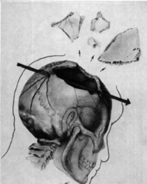 肯尼迪被一枪"爆头",其妻惊慌捡"头盖骨",图7狙击手的位置_子弹_妻子