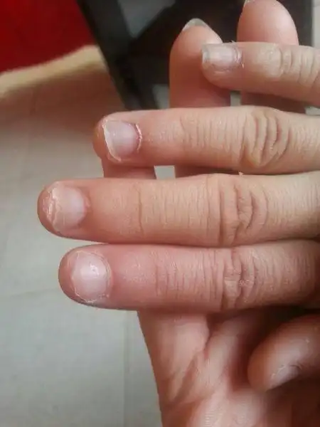 我闺女今年七周多,看这指甲怎么总这么长啊我很担心,求解这是什么症状