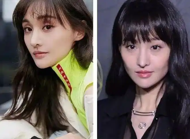 女明星整容意外死亡那些整容的女人后来都怎么样了