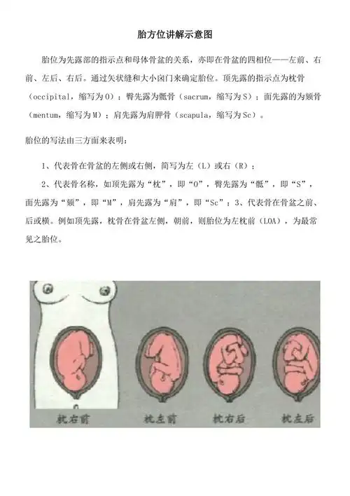 胎方位讲解示意图