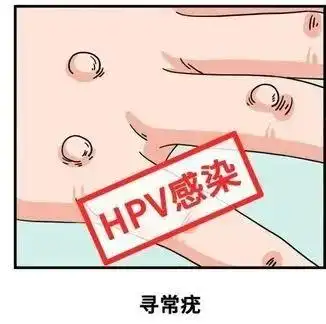 数目不等,初起多为一个,以后可发展为数个到数十个,一般无自觉症状