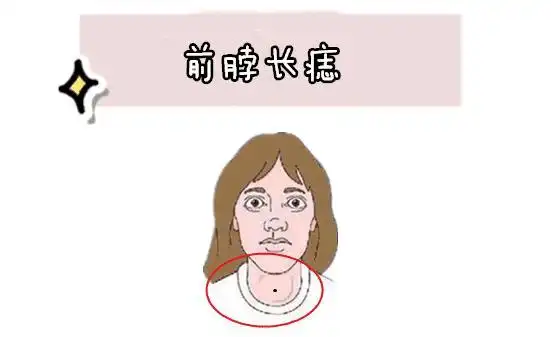 女人4颗"妨夫"痣,上不孝,下不教,花钱大手,不会过日子!