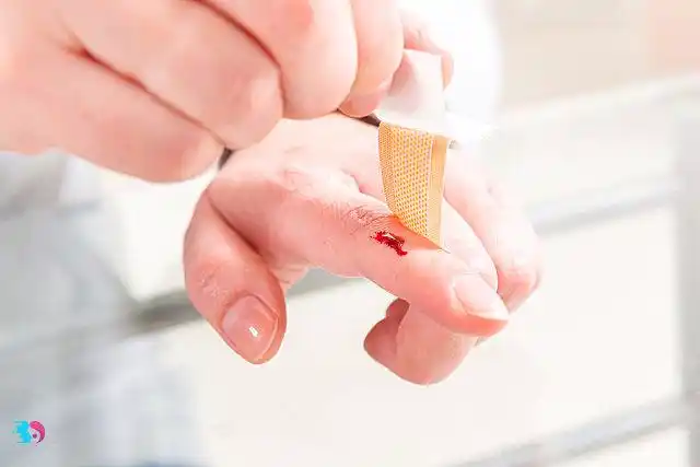 创可贴使用不当竟意外截肢5种情况下千万别用创可贴