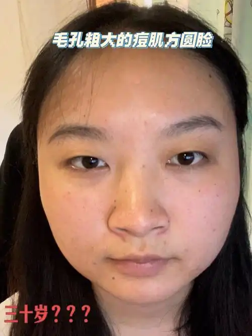 圆脸妆容  #大饼脸  #单眼皮  #妆前妆后   脸型改变不了 只能化妆