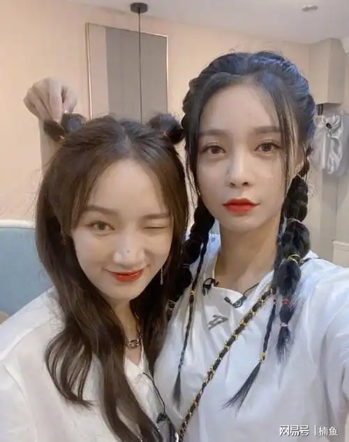 沈梦辰孟佳发量对比一个浓密一个稀少斑秃女孩太真实了