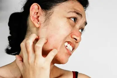 皮肤瘙痒切勿用手