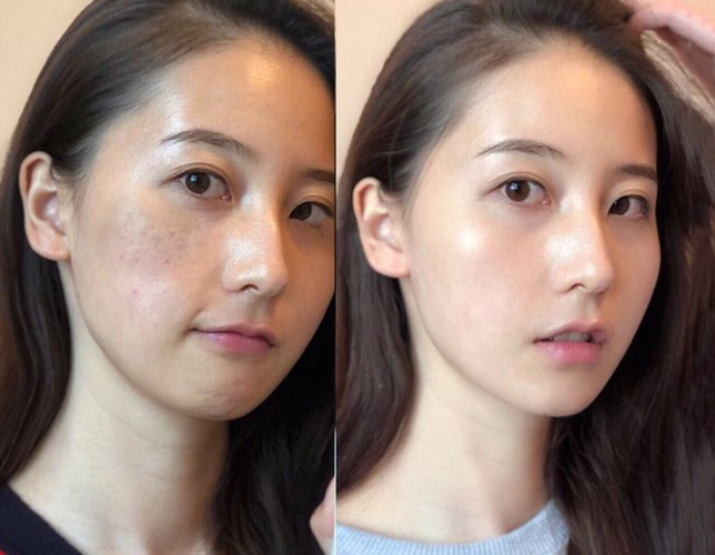 阿本紫璐美白祛斑精华液 | 抹在肌肤上的"美白针",持美白祛斑特证